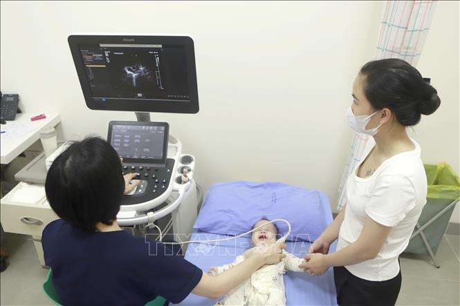 kham-benh-tim-tre-em-04112023-02